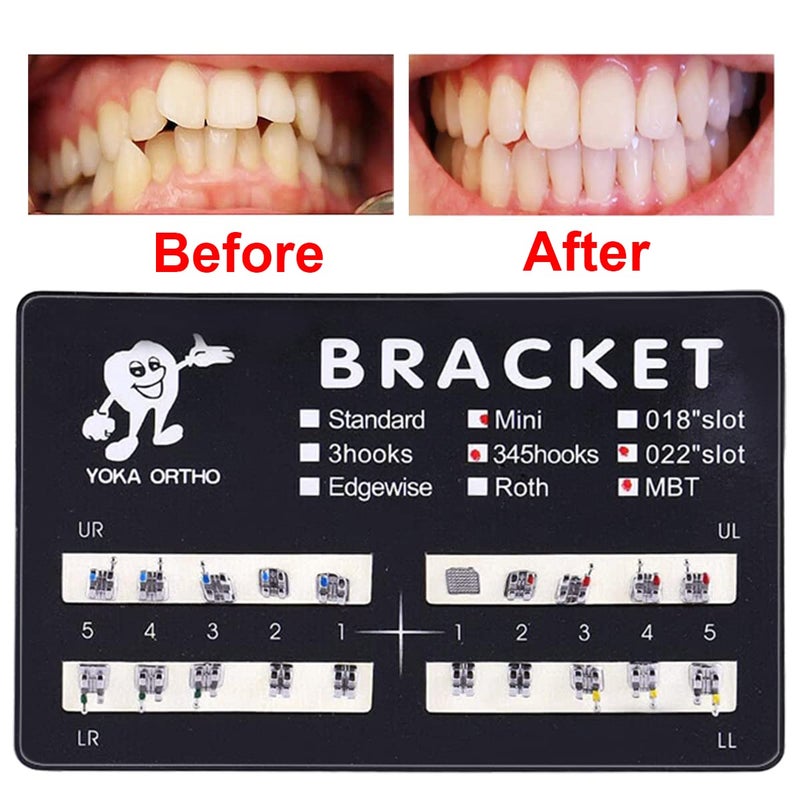 VEZE حاملات الأسنان، حاملات لتقويم الأسنان، 5 مجموعات 100 قطعة نموذج أسنان تقويم الأسنان حاملات MBT مصغرة MBT 022 فتحة قابلة للربط، 345 خطاف. - Image 2